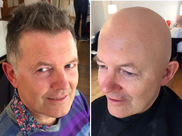 bald cap