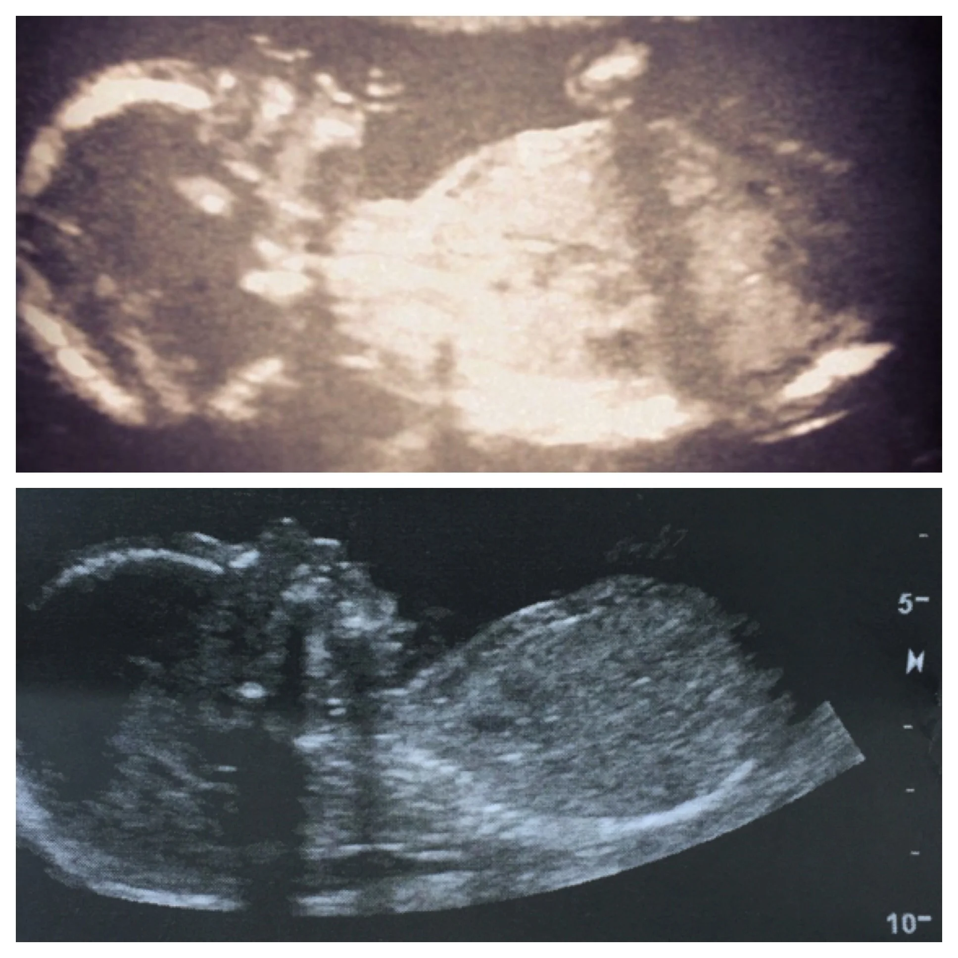 Top one- Grayson... Bottom one- His brother. 