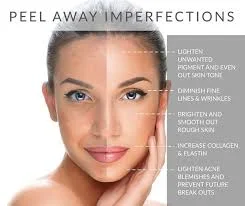 Peel & Heal for beautiful results