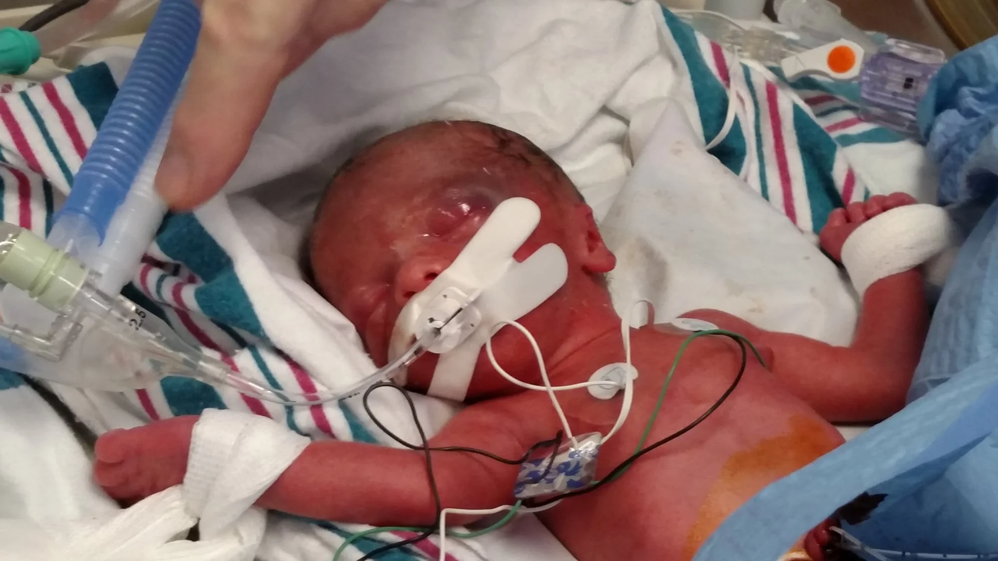 Our Journey Through the NICU. 