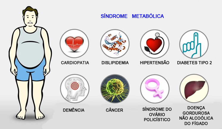sindrome-metabolica.png