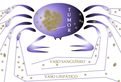 caranguejo.gif