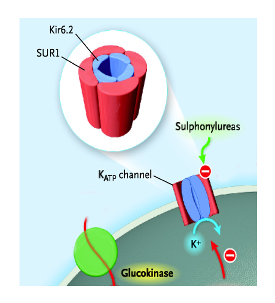 KCNJ11-or-ABCC8.png