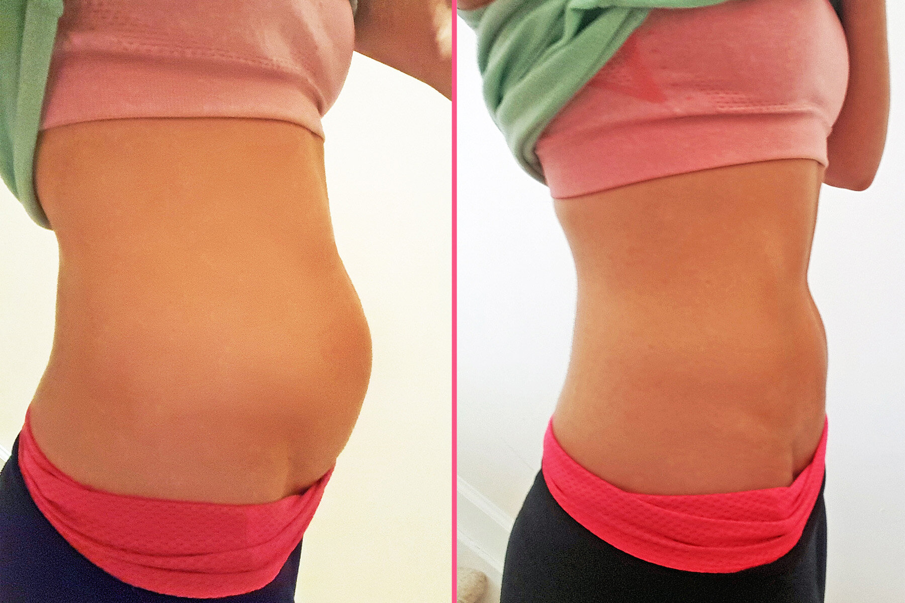 Bloated-Natural-RemediesSm.jpg