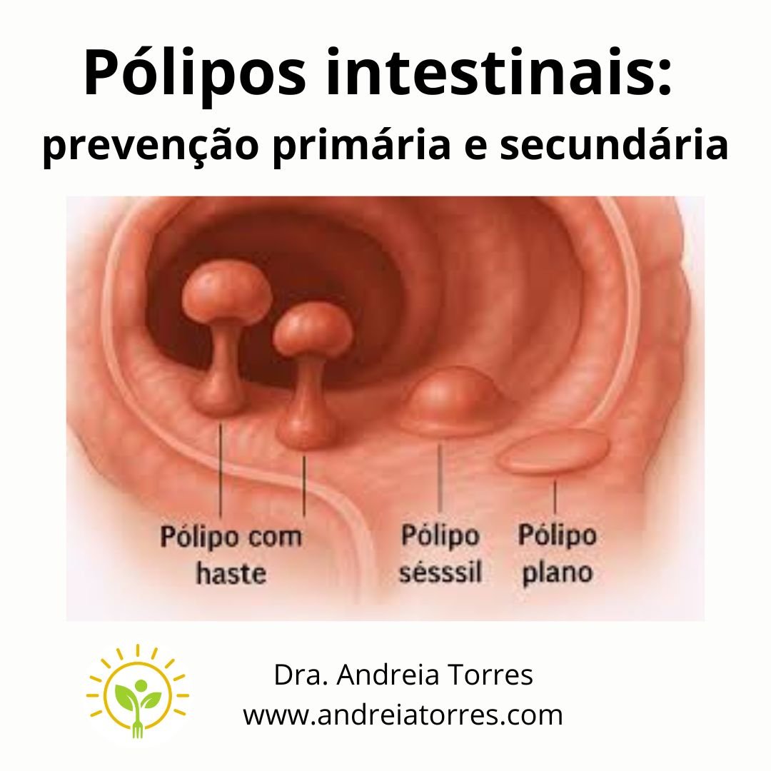 Pólipos intestinais: prevenção primária e secundária