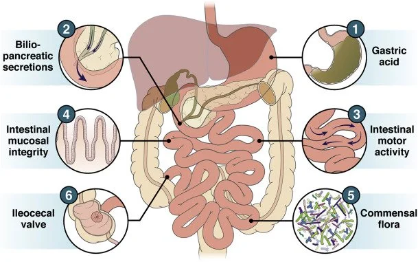 SIBO - SUPERCRESCIMENTO BACTERIANO NO INTESTINO DELGADO
