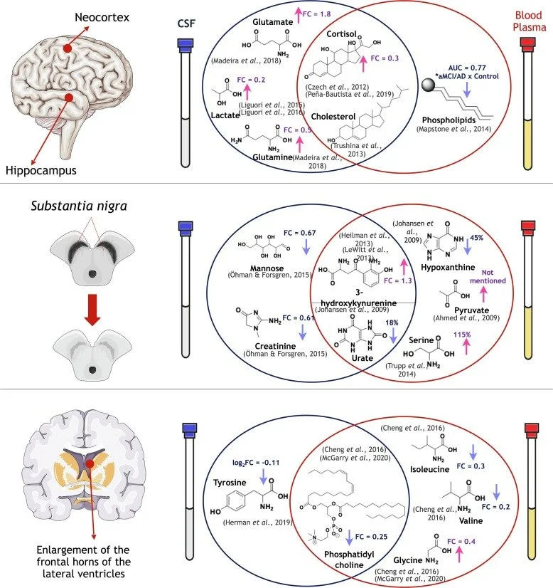 Metabolomica nas doenças neurodegenerativas