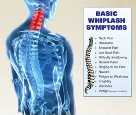 whiplash1.jpg
