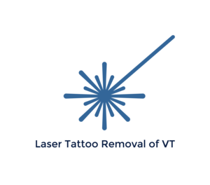 Laser Tattoo Removal of Vermont