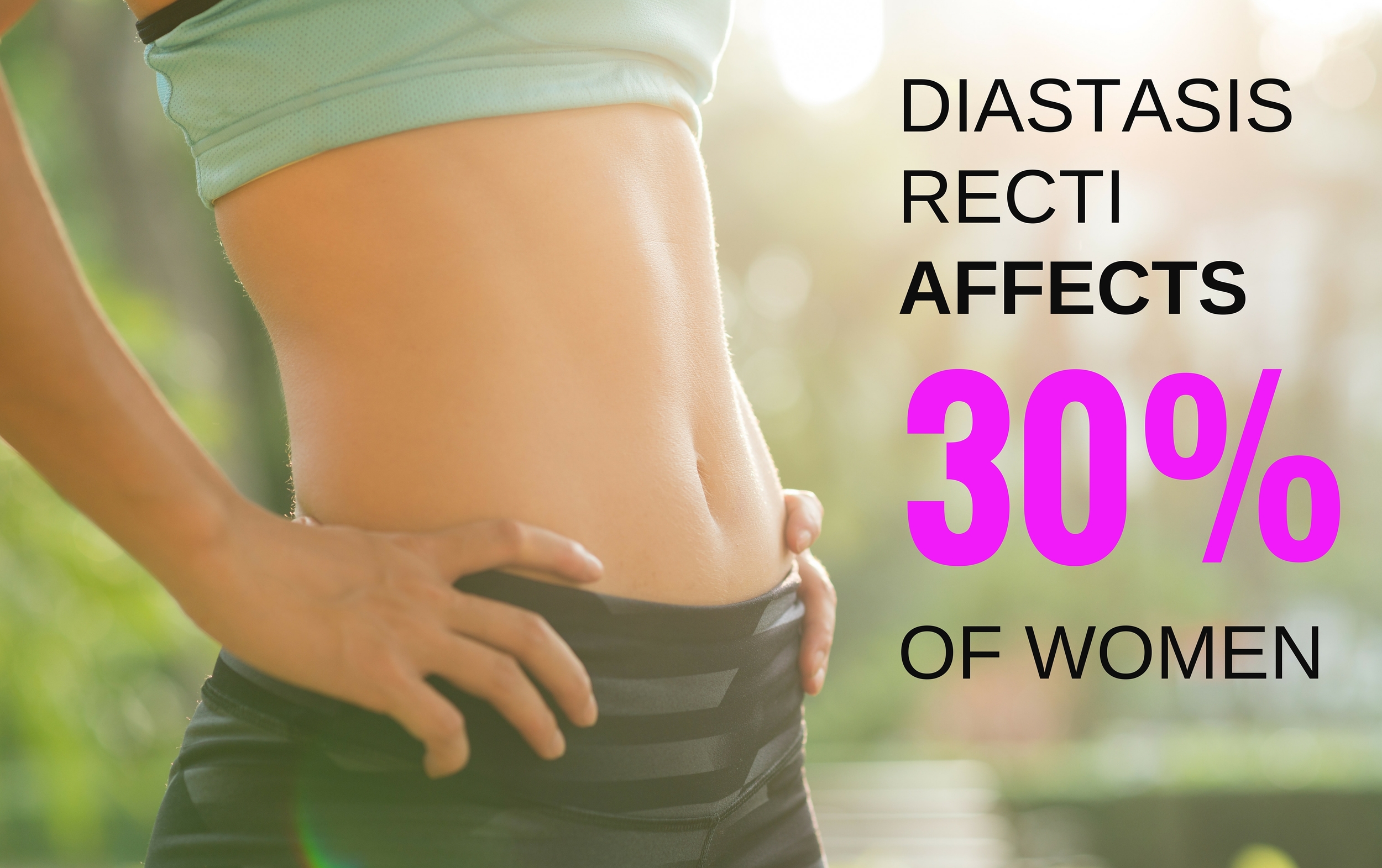 Diastasis Recti Everything You Need To Know