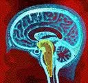 reticular-activating-system-photo.jpeg.pagespeed.ce.Vwy933MoYX2.jpg