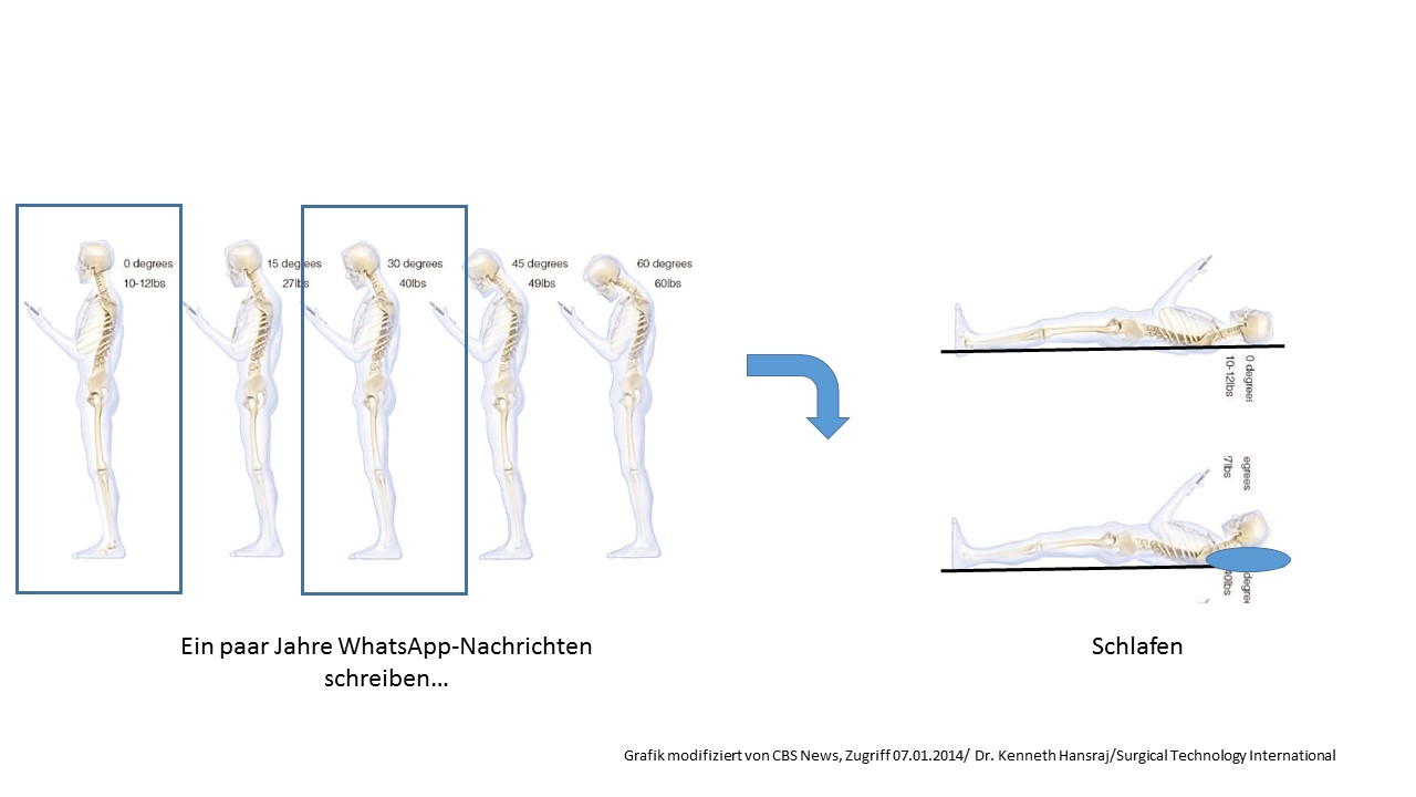 Smartphone anschauen vs Schlafen. Die Darstellung/Analogie ist natürlich stark vereinfacht, da die Schwerkraft in beiden Fällen nach unten wirkt, und damit die Lastprofile und Krümmungen im Liegen anders sind als im Stehen. Trotzdem, in einem reduzierten biomechanischen Modell drückt das Kissen den Kopf-Nacken-Schulter/BWS-Komplex in ähnlicher Weise nach vorne wie die Handy-Interaktion. Was ich damit auch sagen will: Während wir uns um ersteres n ziemlichen Kopf machen, nehmen wir letzteres jede Nacht ohne Weiteres in Kauf. Kissen, anyone?