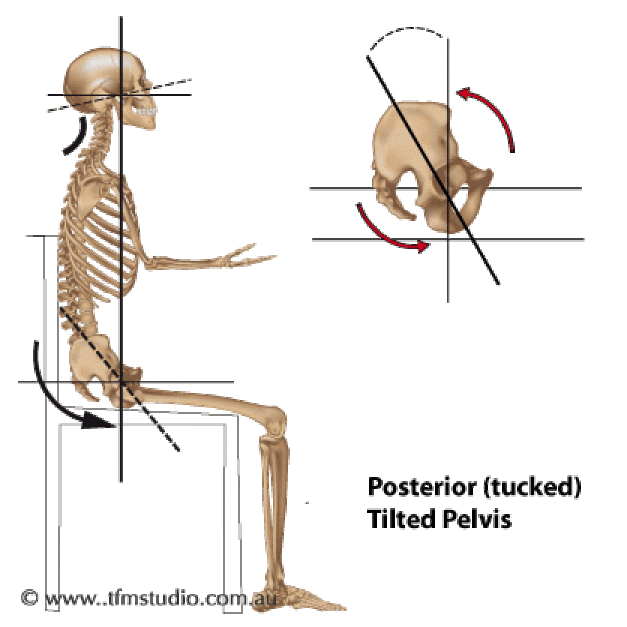 (Von http://www.tfmstudio.com.au/posture/sitting-posture-patterns/)