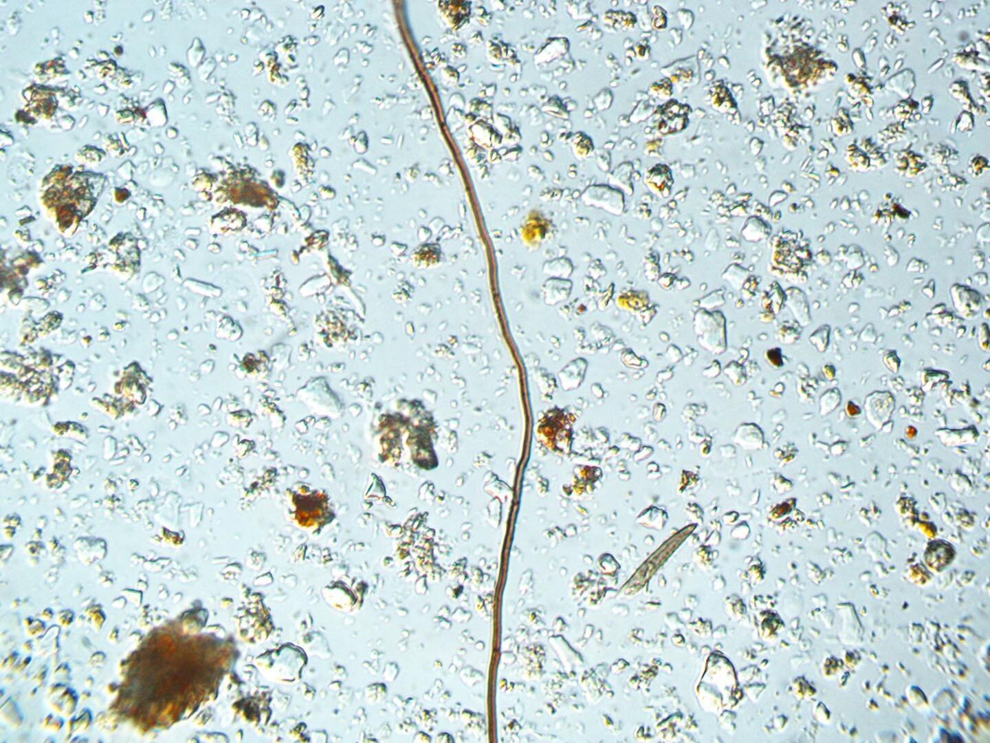 Photograph of fungal hypha sampled at our ongoing CSBI planting project. Fungal hyphae live within soil. They are microscopic tubelike shoots of fungi that form the mycelium network that exist in healthy soil. Fungal hyphae, like the one pictured abo