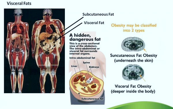 Body Fat Distribution