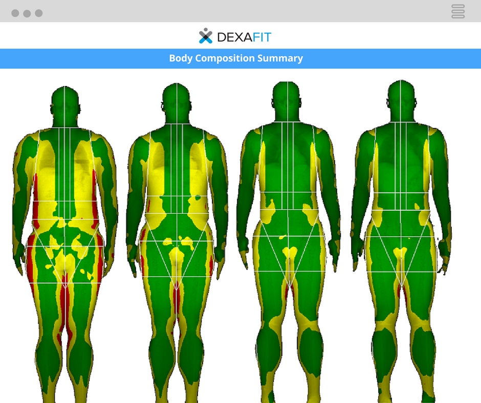 Fit AI - Artificial Intelligence from DexaFit