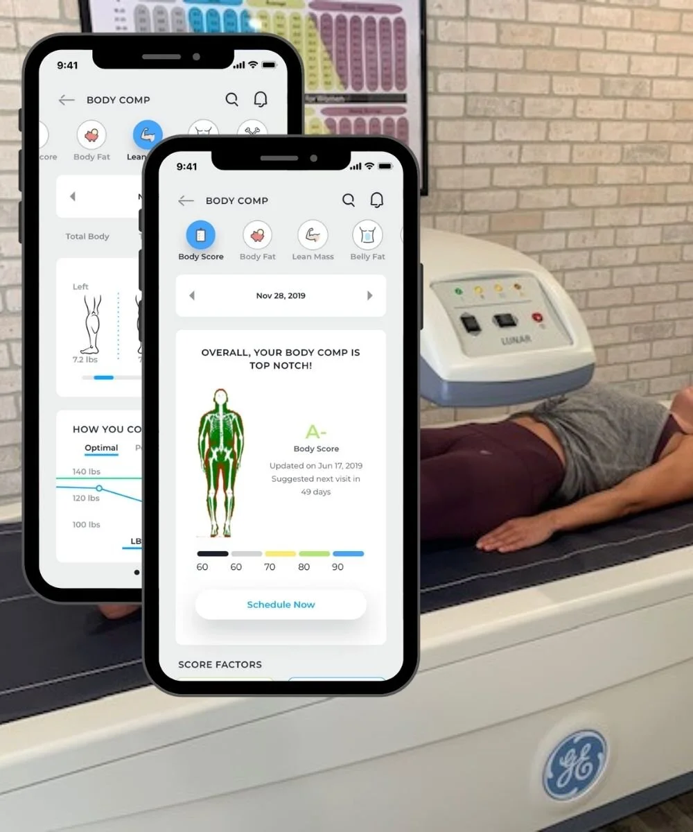 Dexa (DXA) Scans Body Fat Testing DexaFit