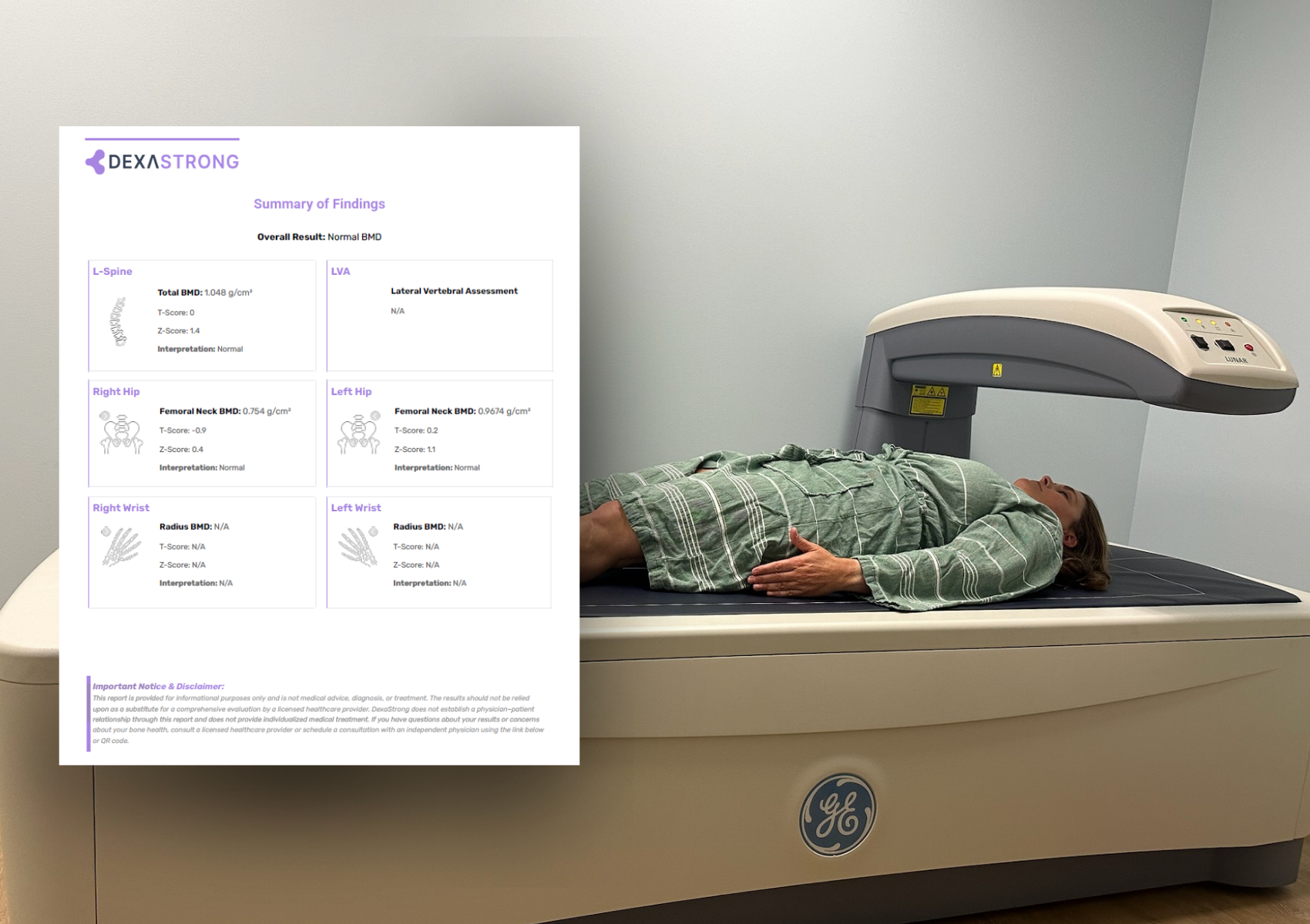 DexaStrong Site-Specific Bone Density Scan