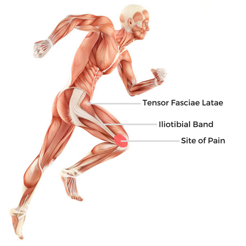 Iliotibial Band Syndrome: Understanding Biomechanics & Common Risk Factors  — Revive Sport & Spine