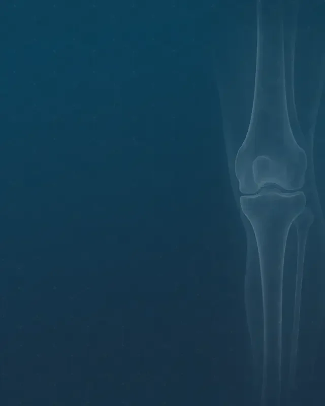 Understanding Knee Osteoarthritis: The Anatomy and How It Actually Develops
