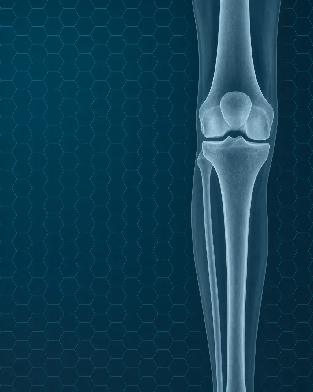 Knee Osteoarthritis: Risk Factors, Prevention, Nutrition, and When to Seek Care