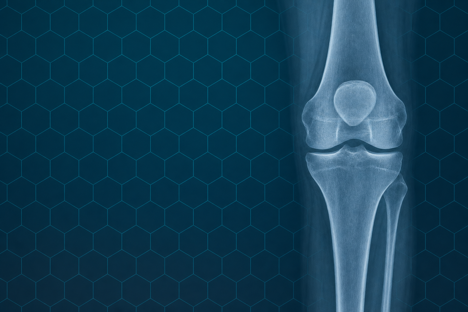 How We Treat Knee Osteoarthritis: Soft Tissue Therapy, Joint Manipulation, and Shockwave