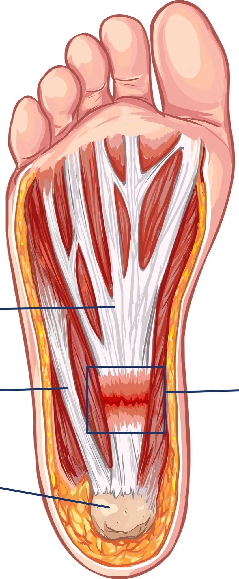 Plantar fascia anatomy and how shockwave therapy can help decrease pain and heal damage.