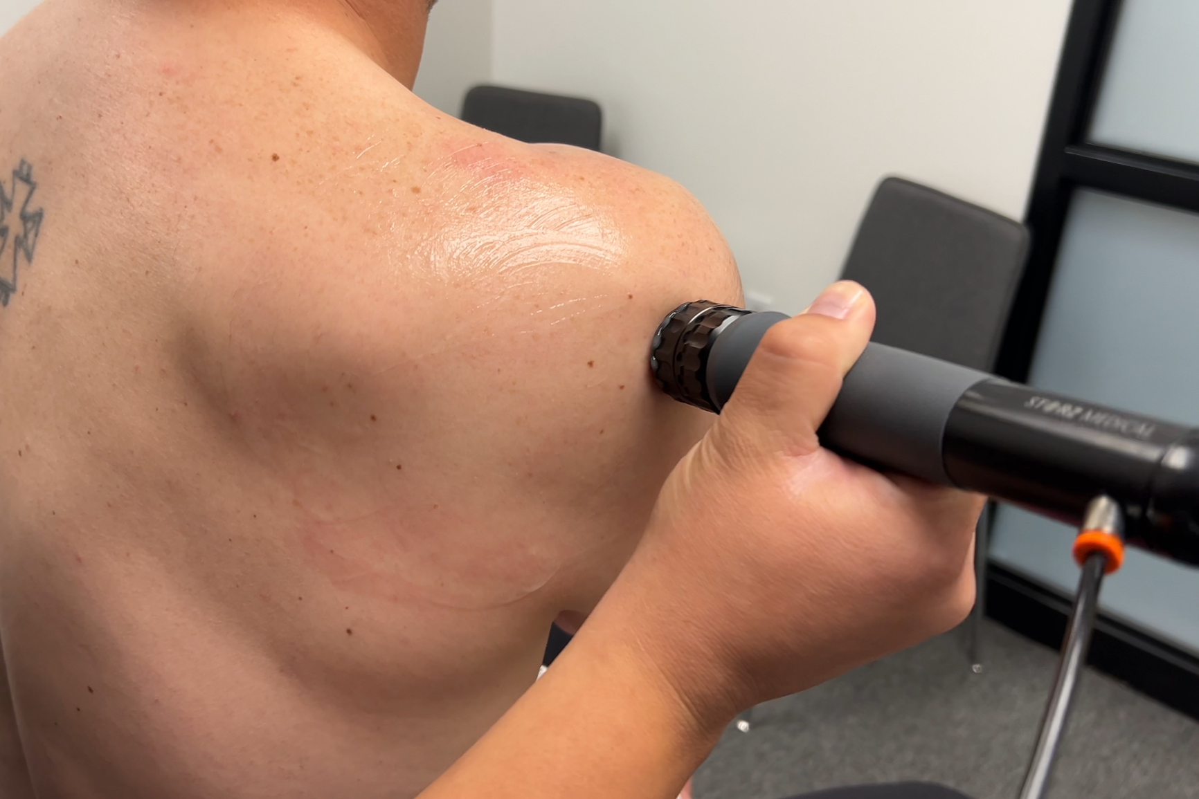 Demonstration of shockwave therapy for shoulder pain, rotator cuff tendinopathy, and shoulder calcific tendinopathy by Dr. Reheisse at Revive Sport & Spine in Murray, Utah.