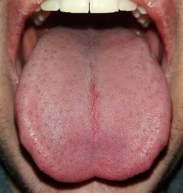 The Power of the Tongue