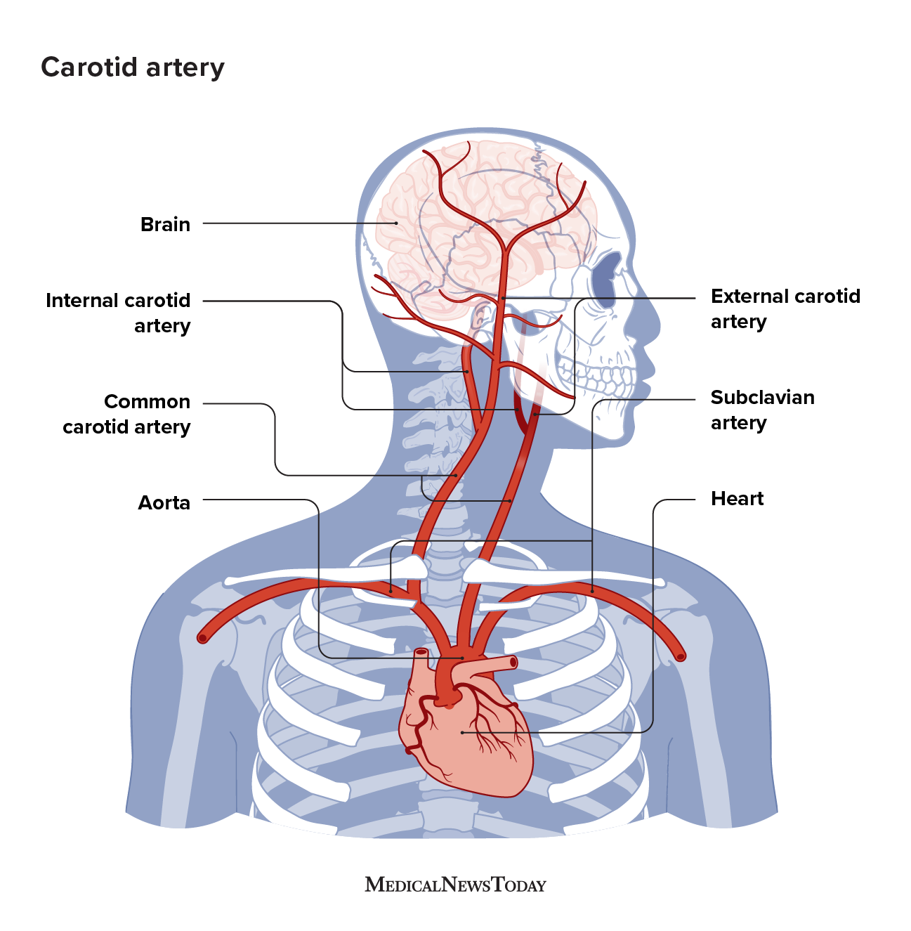 2510857 - carotid artery neck pain_1296x1324-body.png
