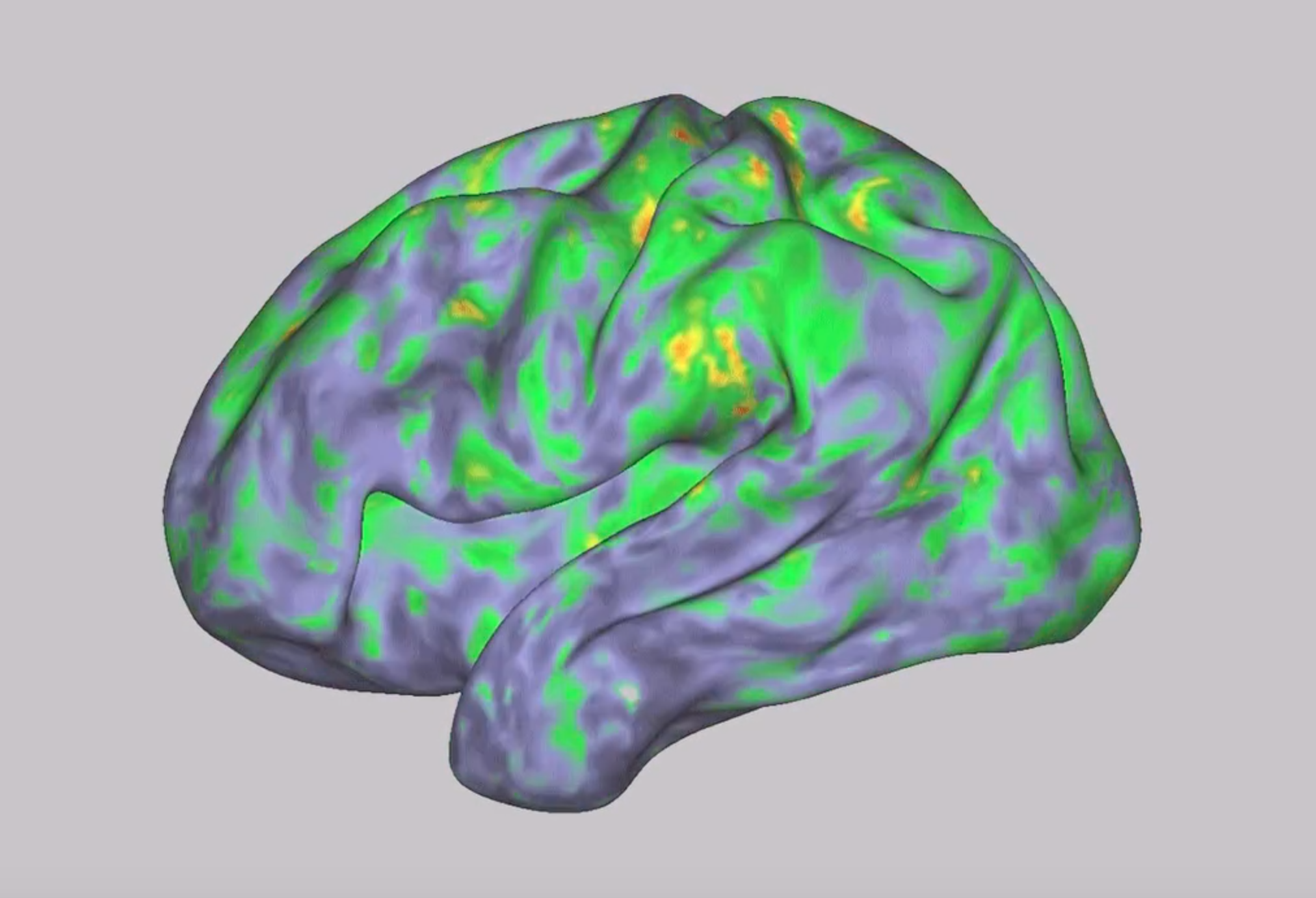 How Psychedelics Impact the Brain