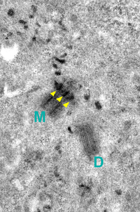 Shown is an EM image of electron dense vesicles (endosomes, marked by yellow arrow heads) interacting with mother centriole appendages (mother centriole marked by M and daughter central marked by D). Image feature in Hehnly et al. Current Bio, 2012.