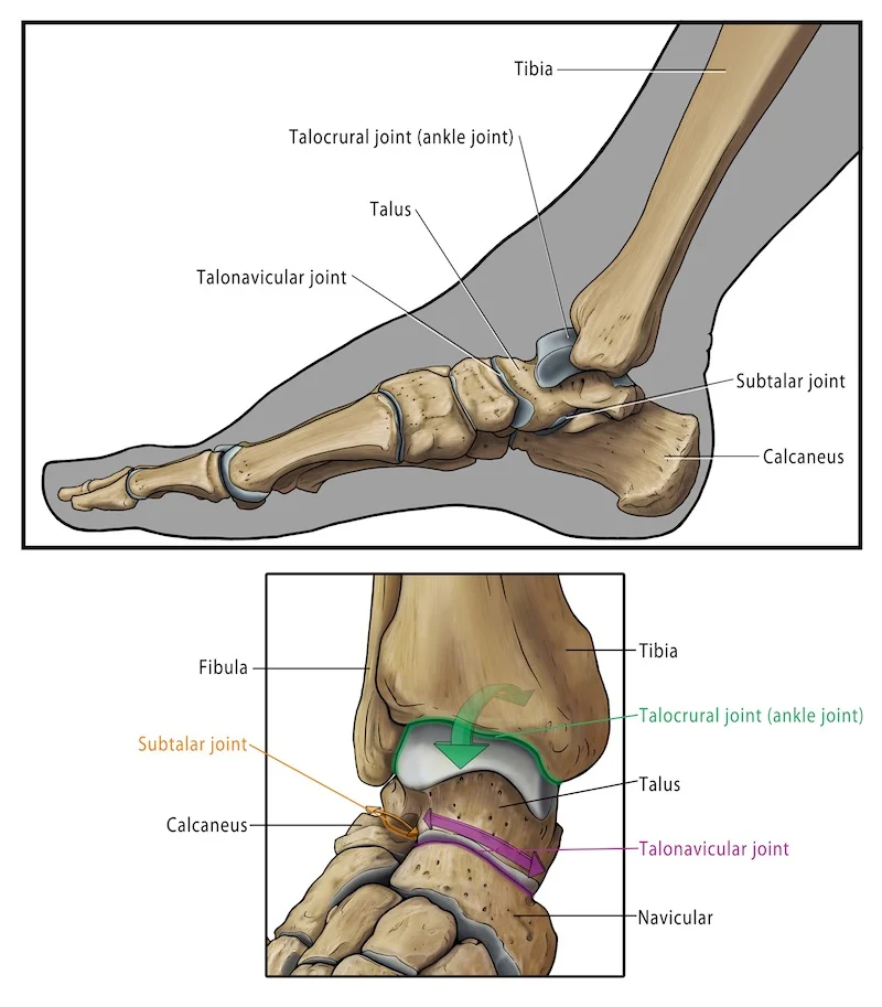 Ankle Arthritis — Ankle Arthritis, Ankle Replacement, Arthrodesis