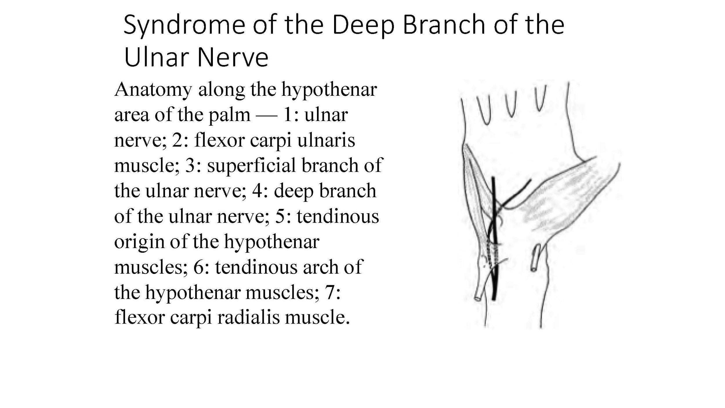 Nerve Entrapment Complete Notes-_Page_111.jpg