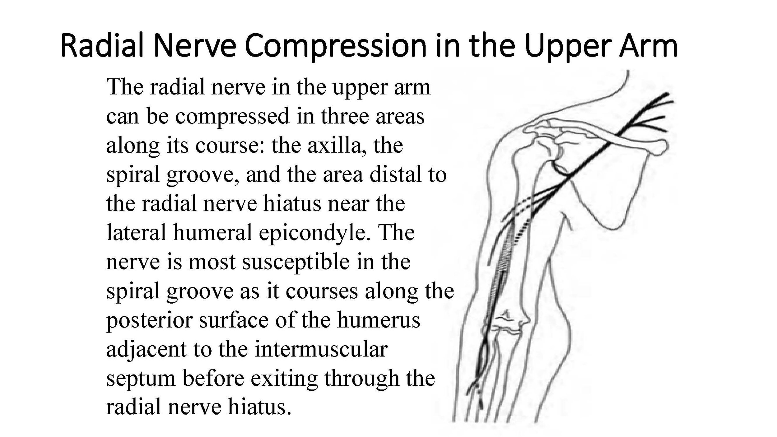 Nerve Entrapment Complete Notes-_Page_118.jpg