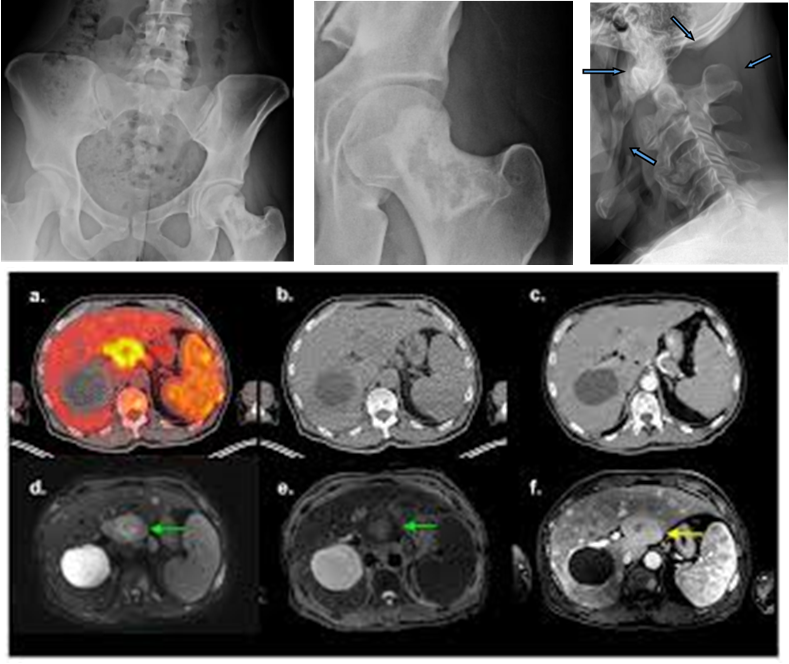 Common Issues You shouldn't Miss on Imaging