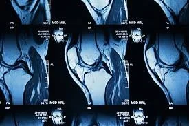Understanding Diagnostic Ultrasounds: Extremity MRI and Ultrasound
