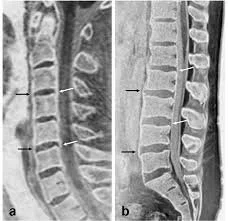 Lumbar &amp; Cervical Imaging with Instabilities, Oddities, and Surprises