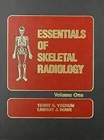 The Truth &amp; Realities of Spondylos with Dr. Terry Yochum 