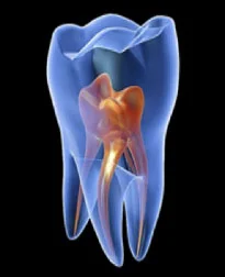 endodoncia.jpg