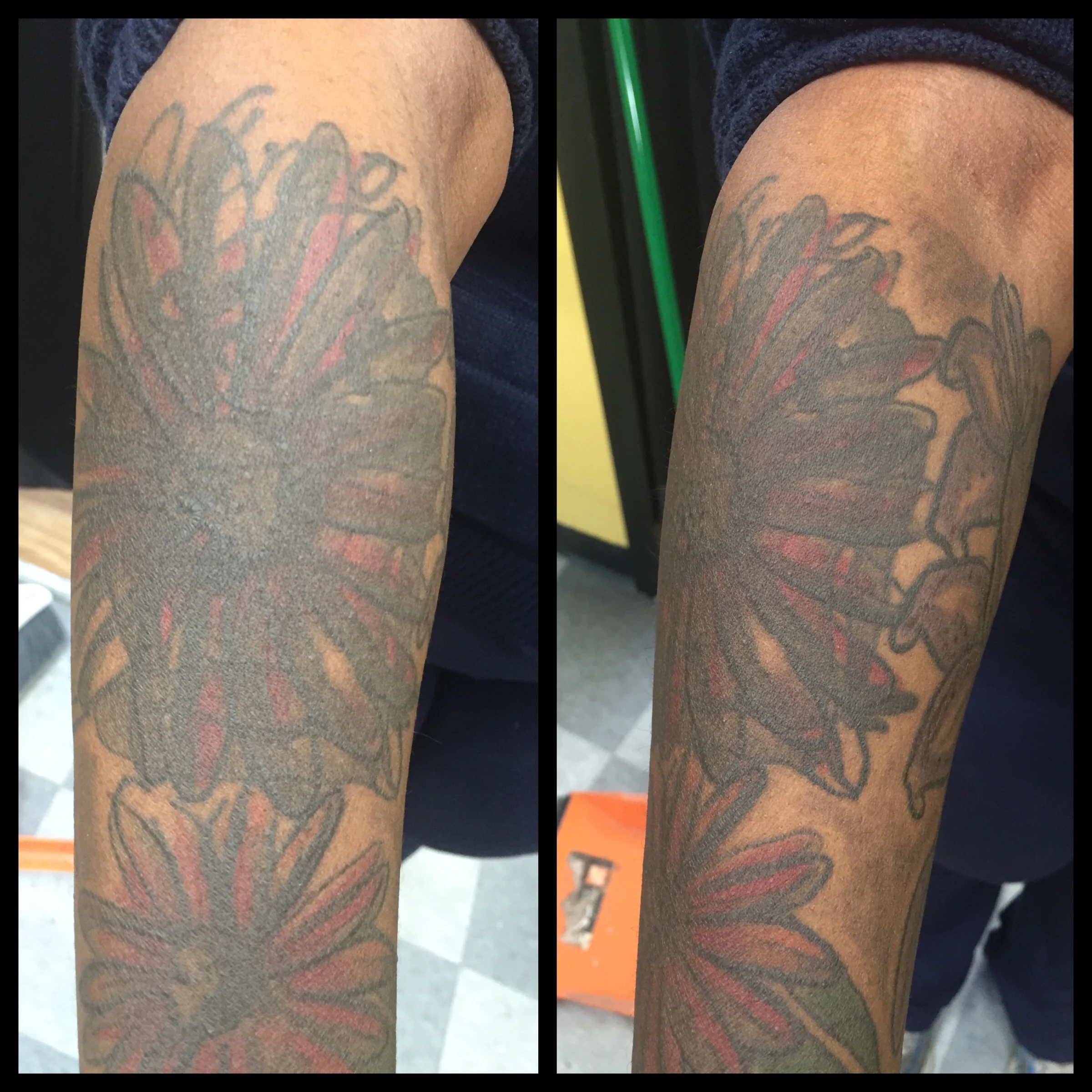 Before cover up