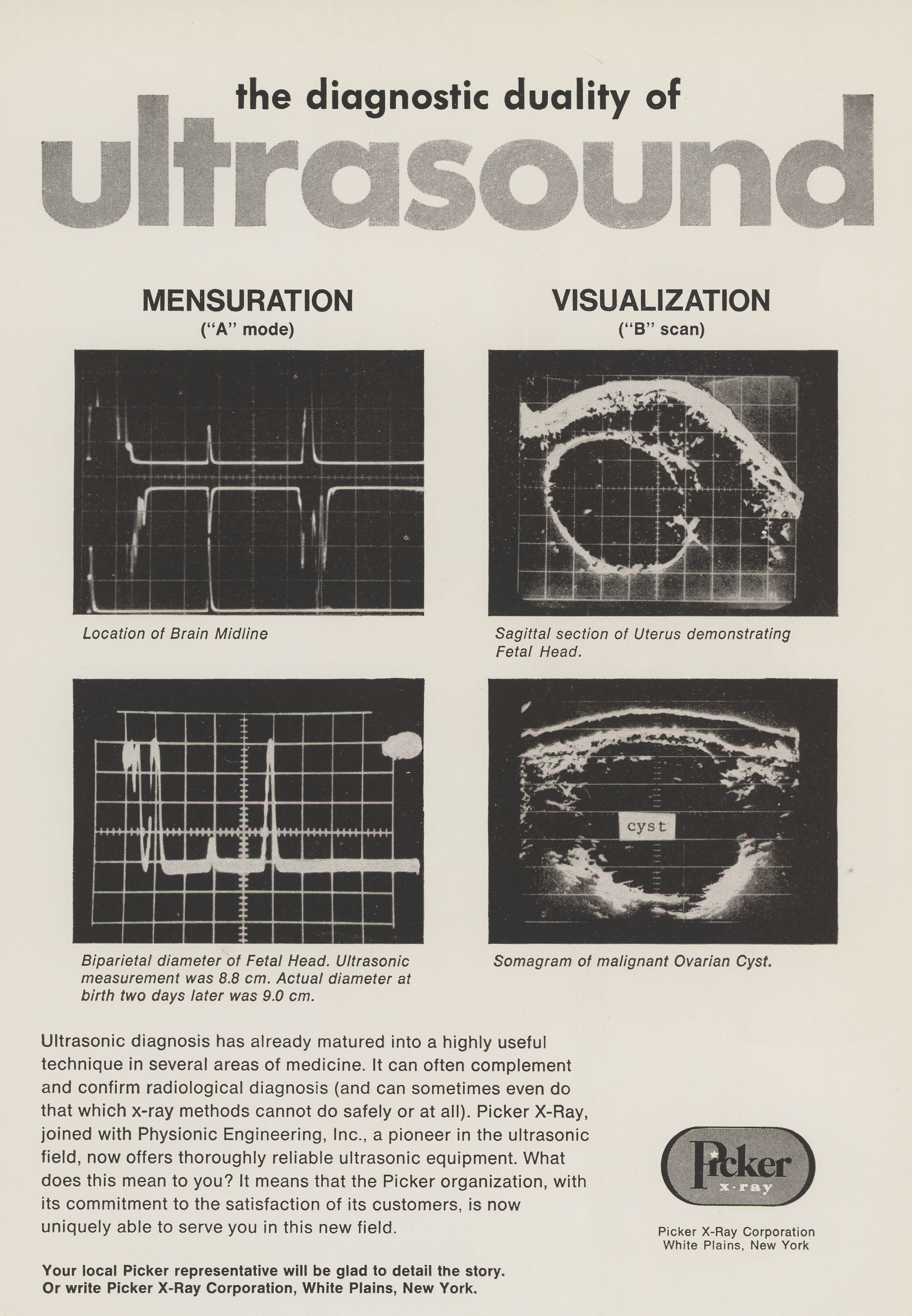 This Is Not a Heartbeat