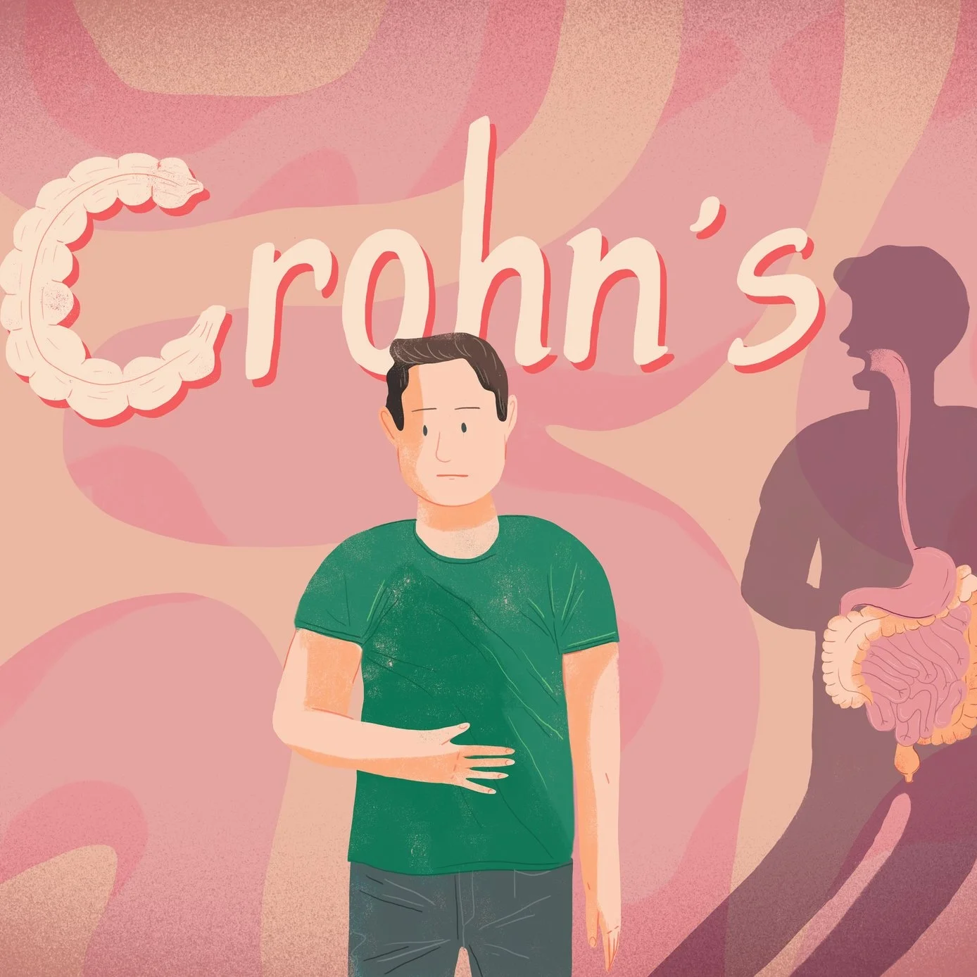 Crohn’s Xplained