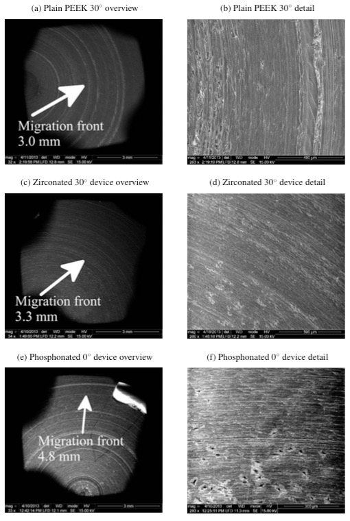 Figure 13: Migration fronts for devices that showed evidence of cell adhesion. This result is interpreted with care due to inaccuracies in the plating process.