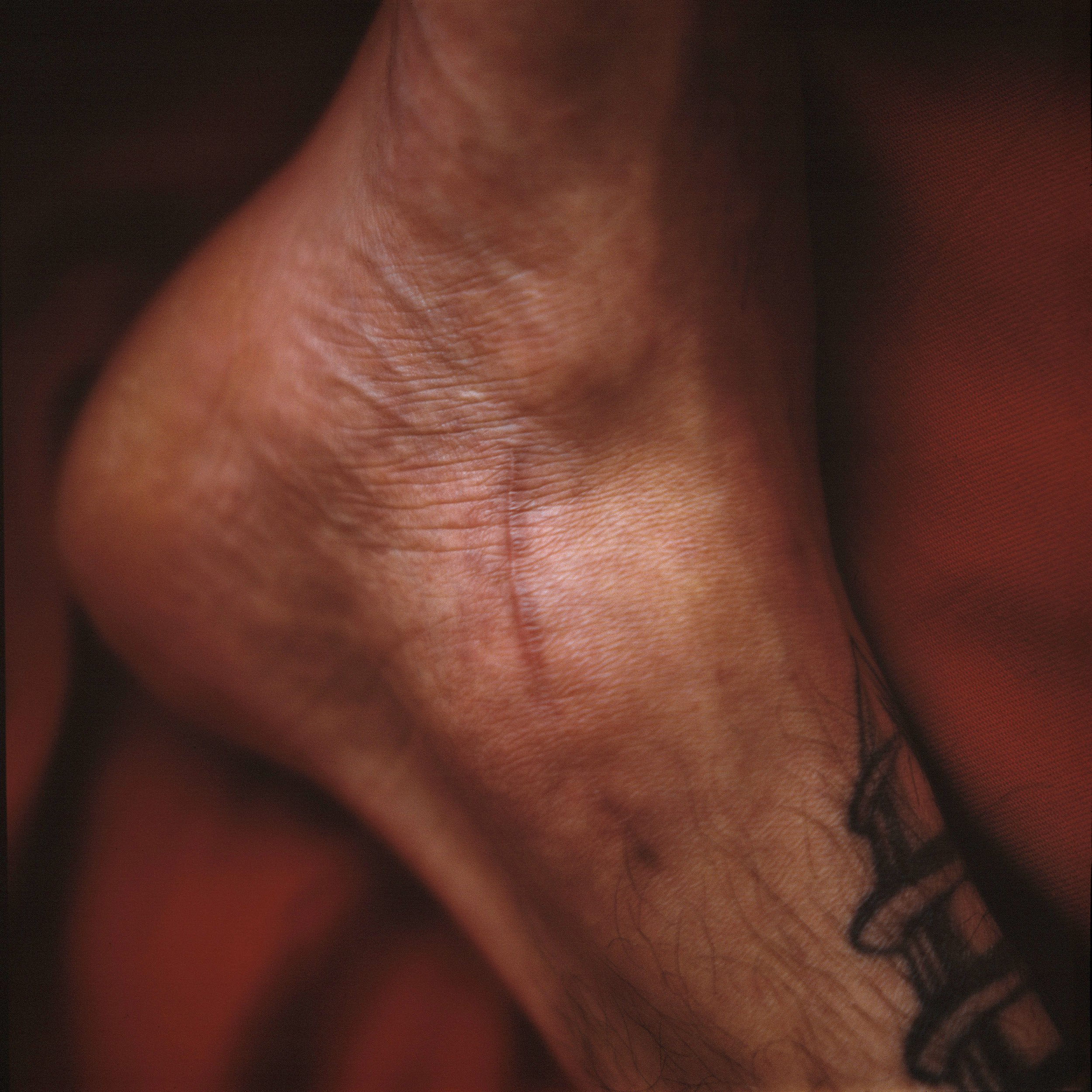 Landscape of wounds 01.jpg