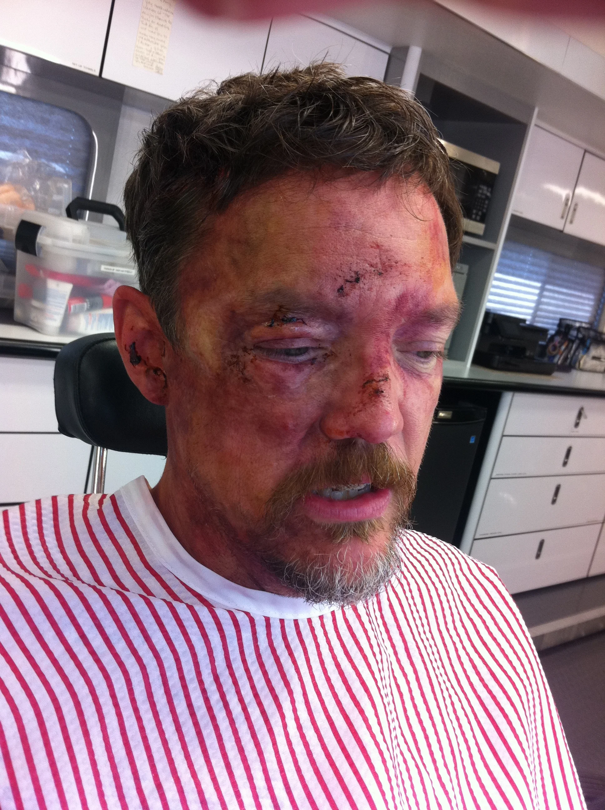 This is Matthew Lillard (Shaggy in the Scooby Doo movies) after he fell of a bridge in the TV show “The Bridge”. FX Channel