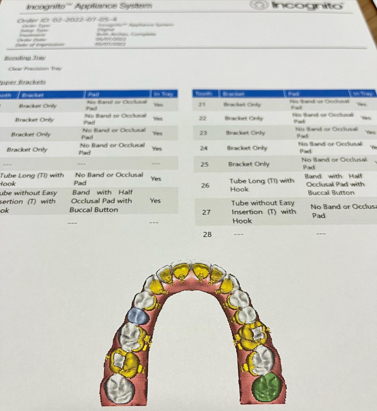 Revisi&oacute;n del tratamiento planificado
✨Empleamos tiempo antes de comenzar el tratamiento de ortodoncia lingual para repasar todo el proceso
✨Dise&ntilde;o del bracket y de los arcos
.

.
#ortodonciaojanguren #ortodoncialingual #incognitobraces 