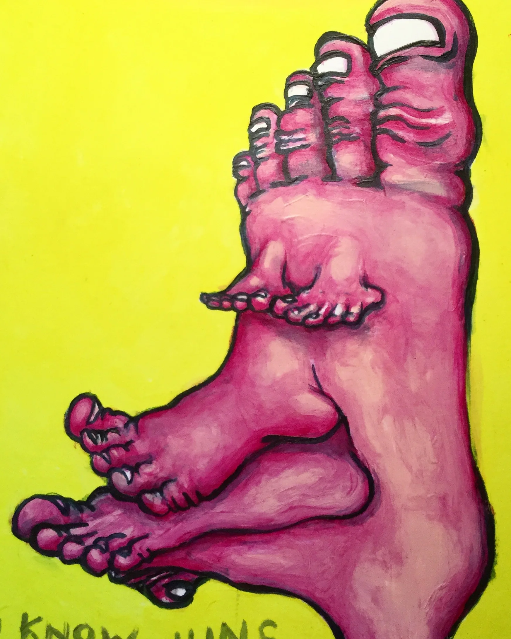 permanent hali-toes-is
