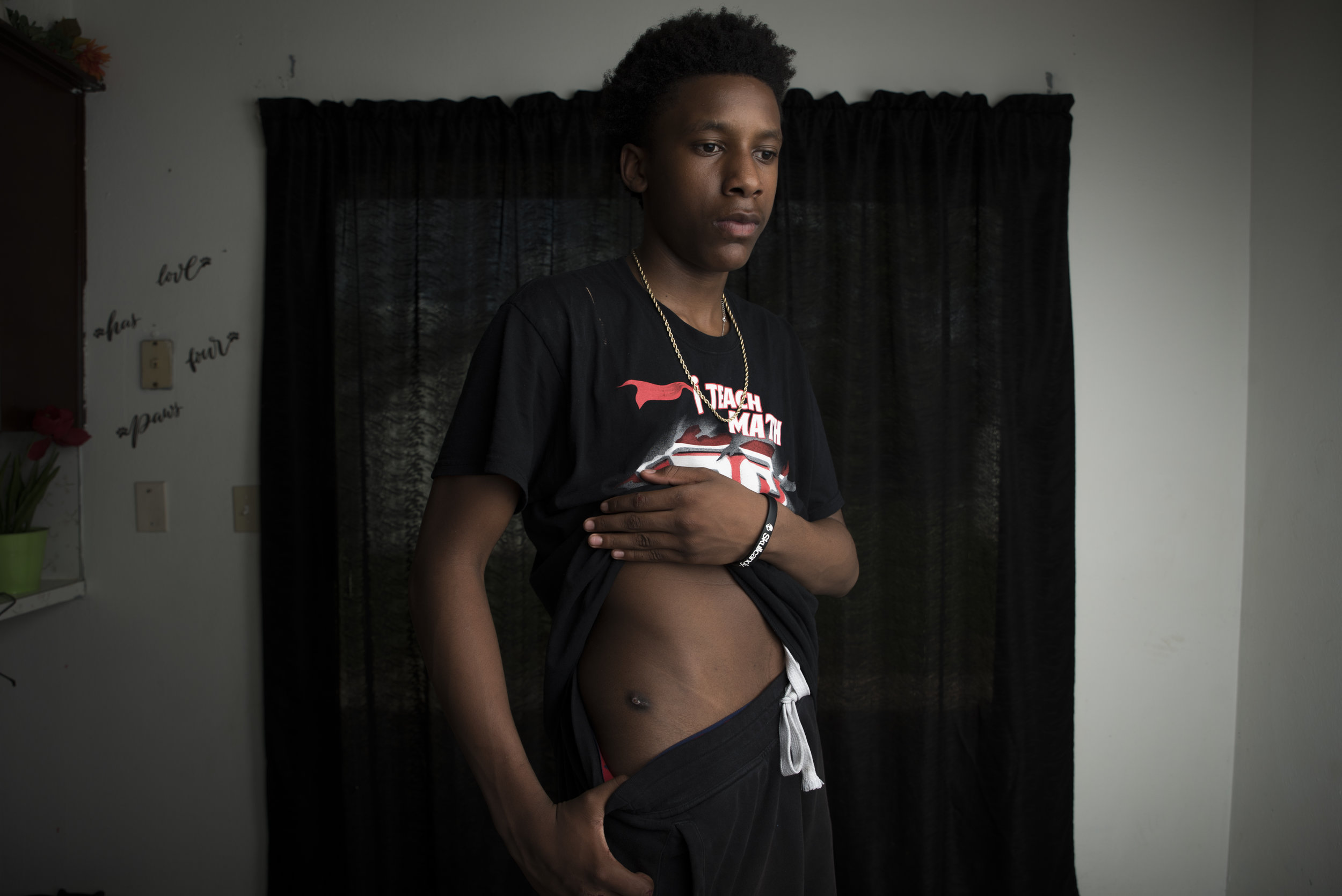  Lorenzo Clerkley Jr. shows one of his bullet wounds at his home in Del City, Oklahoma on May 5, 2019. (Photo by Nick Oxford for The Washington Post) 