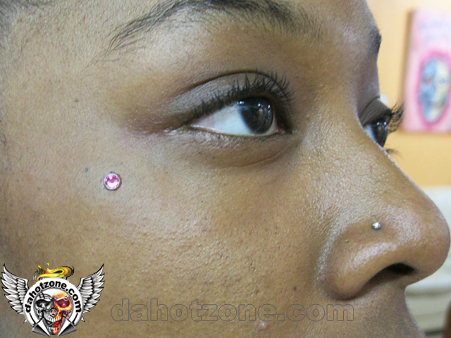 Microdermal